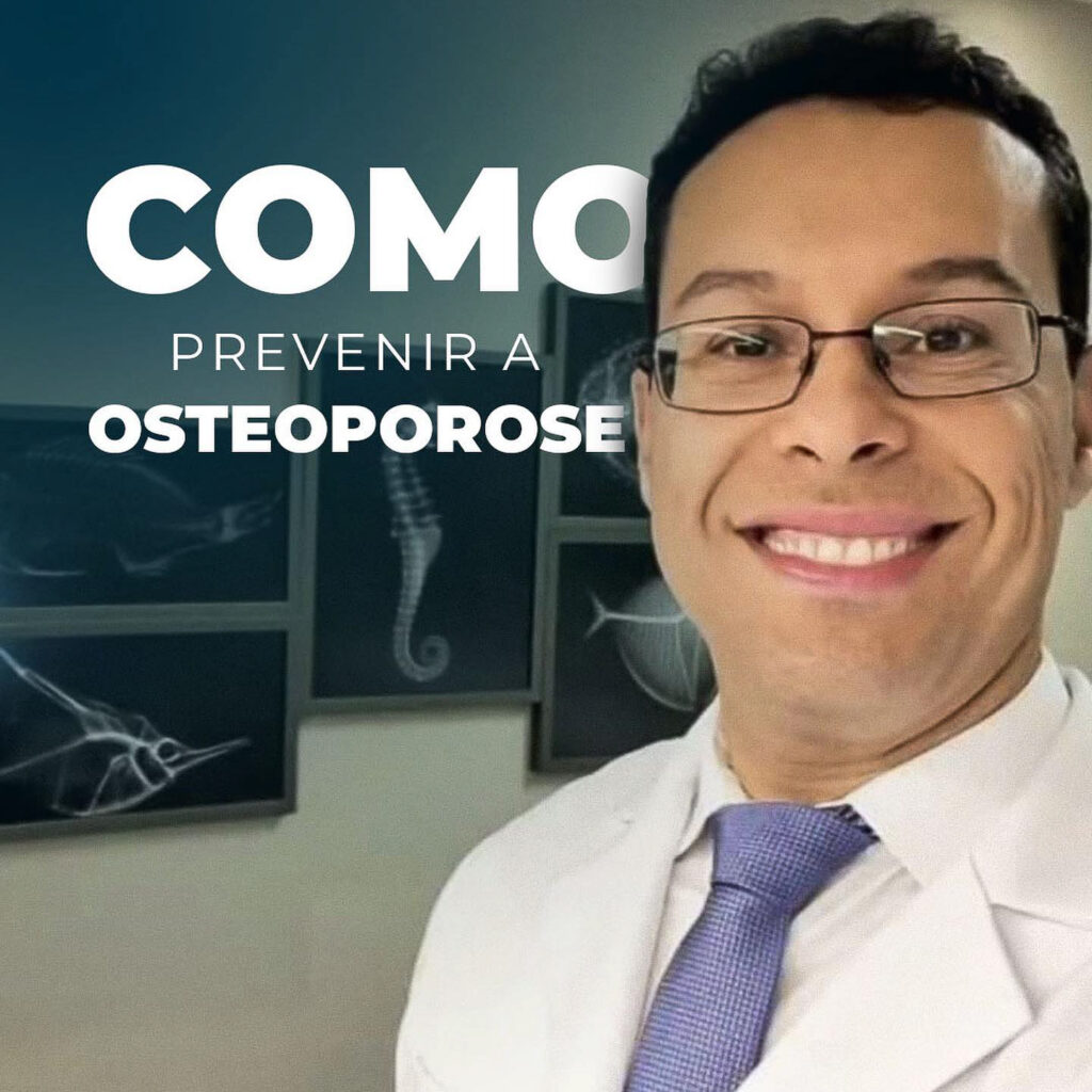 Como Prevenir A Osteoporose Dr Gustavo Barboza