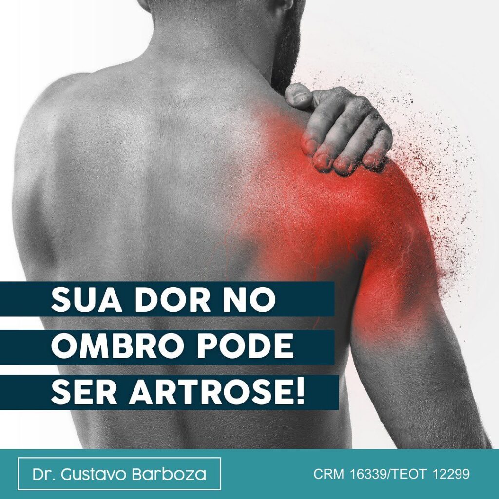 Sua dor no ombro pode ser artrose! – Dr. Gustavo Barboza