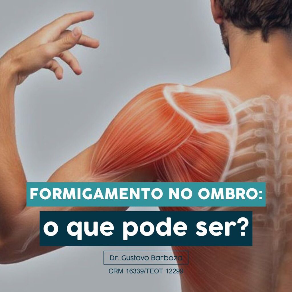 Formigamento no Ombro: o que pode ser? – Dr. Gustavo Barboza